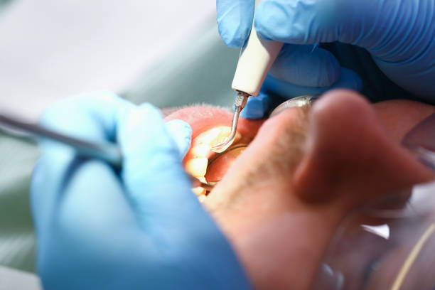 Best Emergency Treatment for Toothache in Pearland, TX